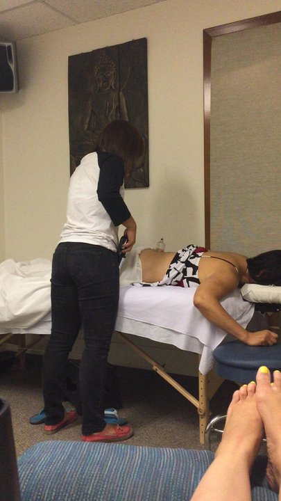 Numo Acupuncture - Cupping - Acupuncture Near Me - San Jose, California
