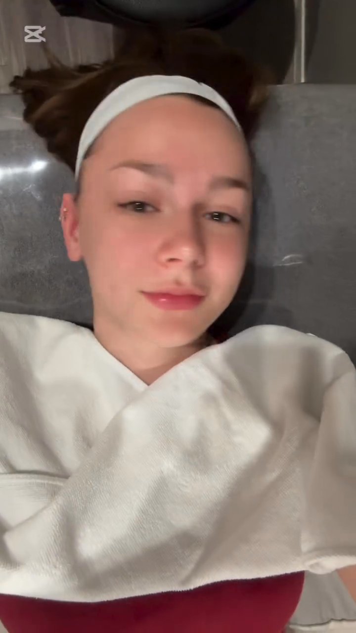 Extraction, V-Beam, Red/Blue LED, Mud Mask (Benjamin Clinic)