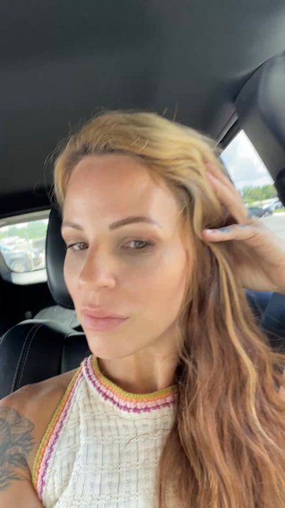 Becky Does Botox - Absolutely NO muscle movement while my eyes are perfectly symmetrical - Medical Spas Near Me - Channelview, Texas