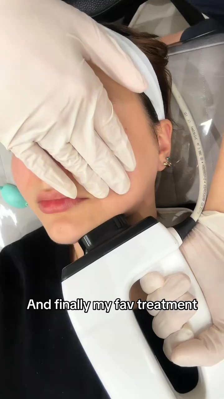 Aqua Peeling, Laser, In-Mode FX, Calming Pack (Benjamin Clinic)