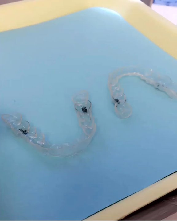 Kevin S Sugiki, DDS - invisalign aligners are easy & quick to put on - General Dentistry Near Me - Honolulu, Hawaii
