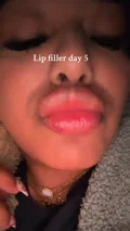 @life.of.les on day 5