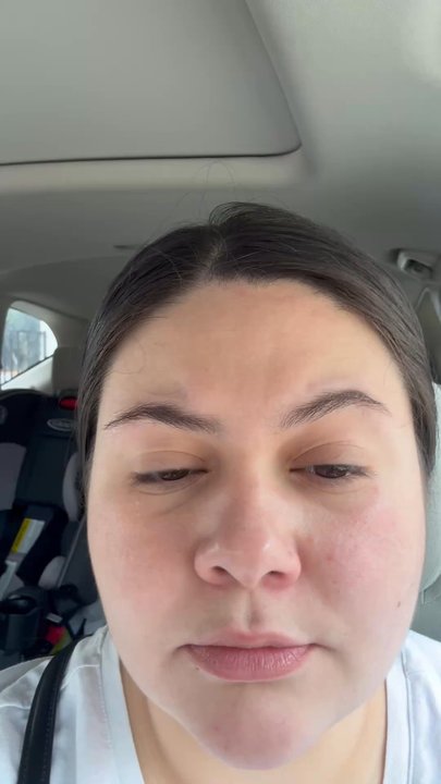 Venus Threading - Before threading. - Threading Services Near Me - Duarte, California
