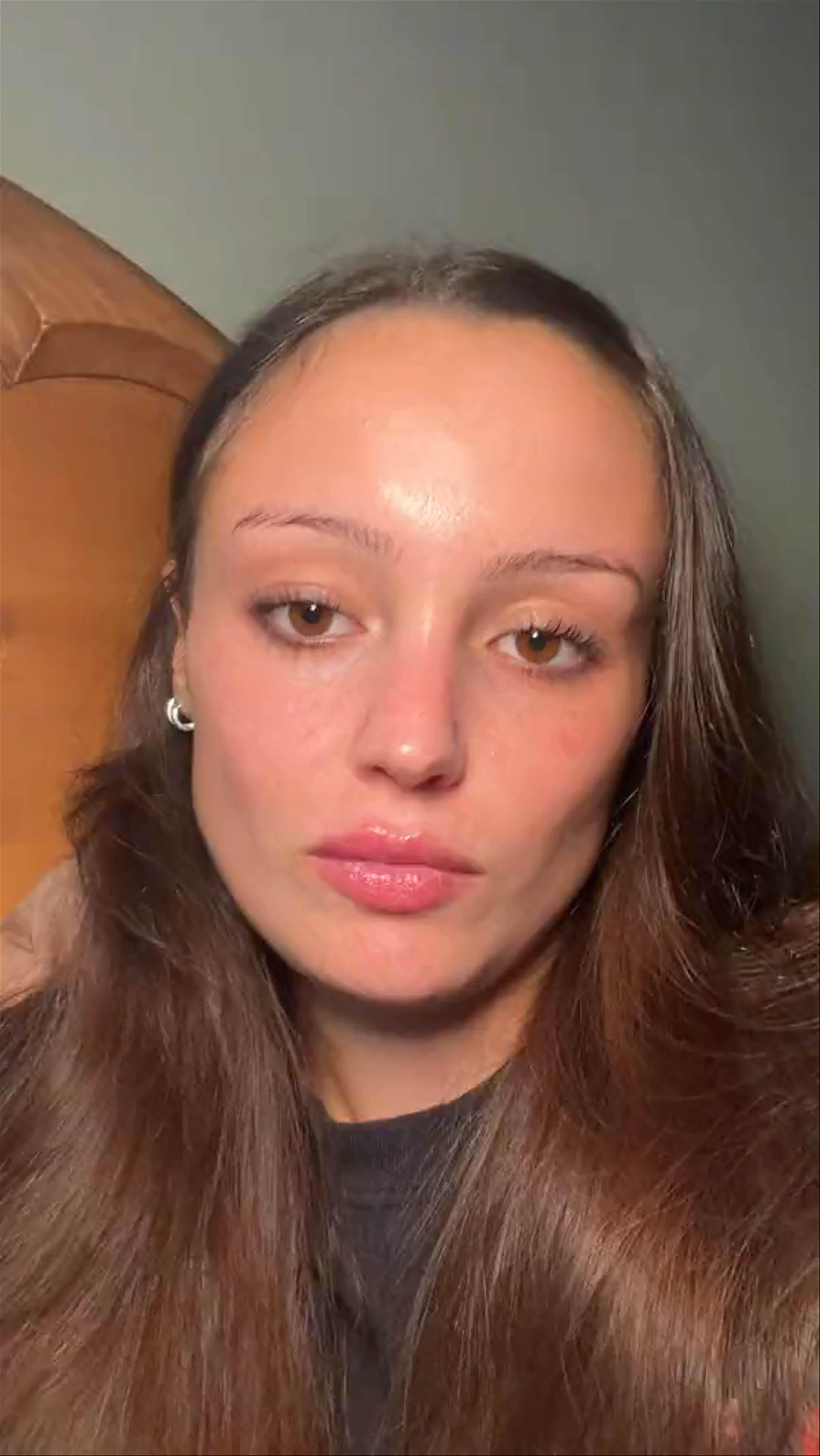 Madeline's Nolla Derm testimonial