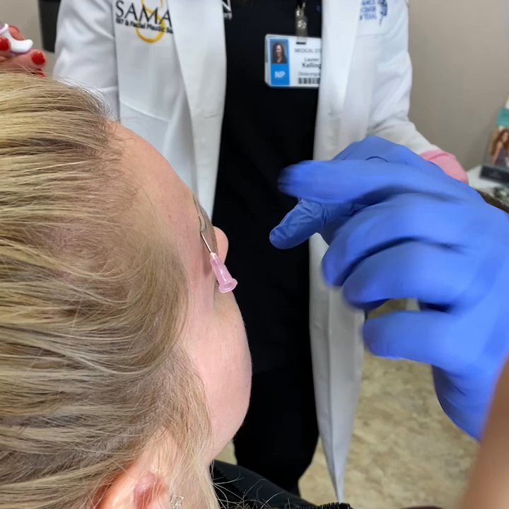 Saman ENT & Facial Plastic Surgery - Trying to get rid of a scar from a accident - Ear Nose & Throat Near Me - Plano, Texas