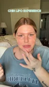 Marissa McKey describes her 2023 patient-reported chin liposuction payment