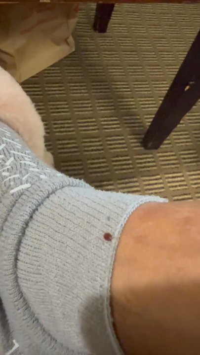 North Bay Inn - A live bed bug!!! - Hotels Near Me - San Rafael, California