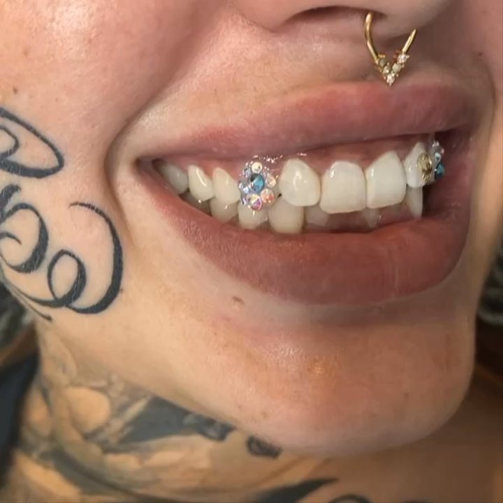 M’s Tooth Gems - Teeth Whitening Near Me - University Place, Washington