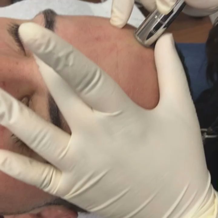 New Skin NYC - Laser Hair Removal Near Me - Maspeth, New York