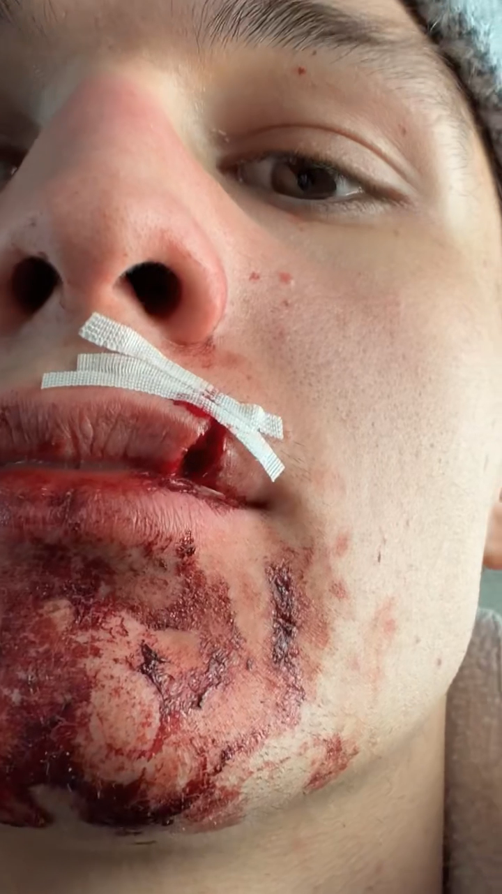 Simon Ward: Stitch Time on the Ice with the Pioneers