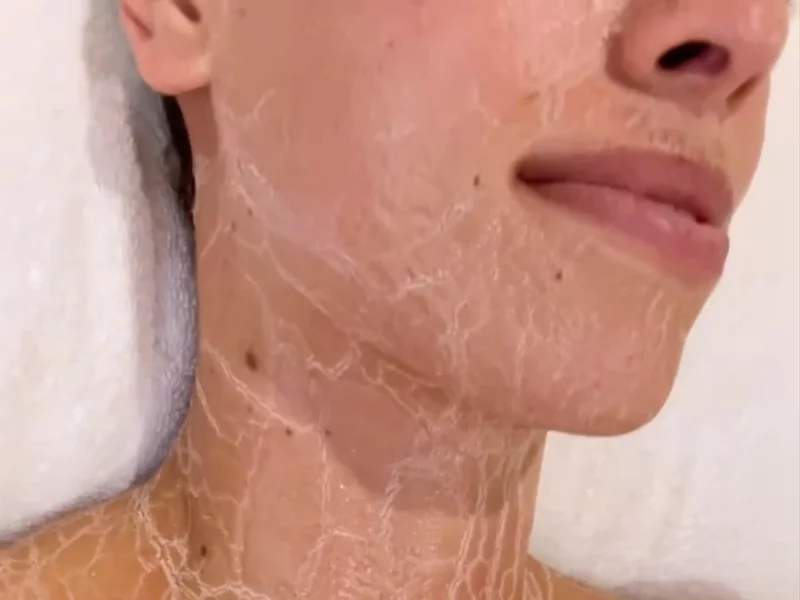 Prin Lymphatic Facial