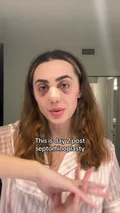 @ericanic0le, day two after combined septorhinoplasty