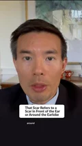 @plasticsurgeryasps · Incision and layer
