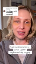 @schweaver5 on getting upper eyelid surgery covered