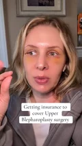 @schweaver5 on getting insurance to cover an upper blepharoplasty