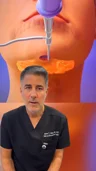 @andrewcohenmd · Fat and deeper structures