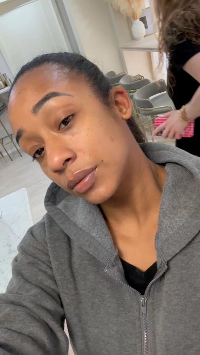 Not Just Lips - I love my results , I looked at this place for years and finally went . I'm so happy with my new lips - Aestheticians Near Me - New York, New York