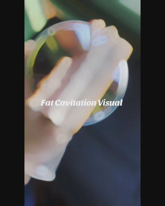 Perfect Skin and Brows - Visual of Fat Cavitation literally melting the fat! - Permanent Makeup Near Me - Ormond Beach, Florida