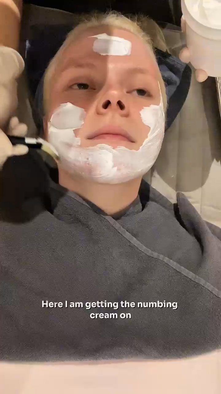 Anna Nerem Nilssen — Treatment Review at Seoul SY Dermatology