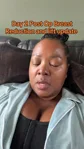 @tomiko.harvey, day 2 after reduction and lift
