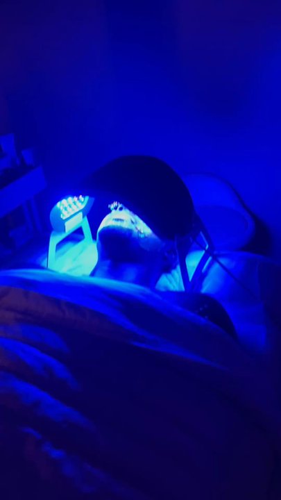 Skin by Wave - Celluma light therapy to target acne bacteria underneath the pores. - Estheticians Near Me - Cypress, California