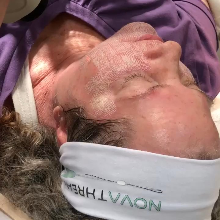 Benjamin Bradford MD - My CO2 laser experience - Plastic Surgeons Near Me - Reno, Nevada