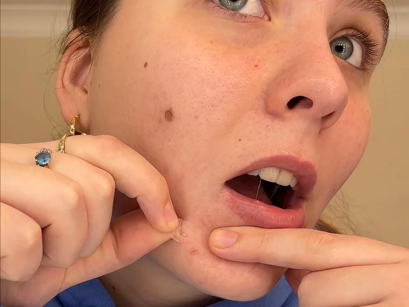 Acne Patches