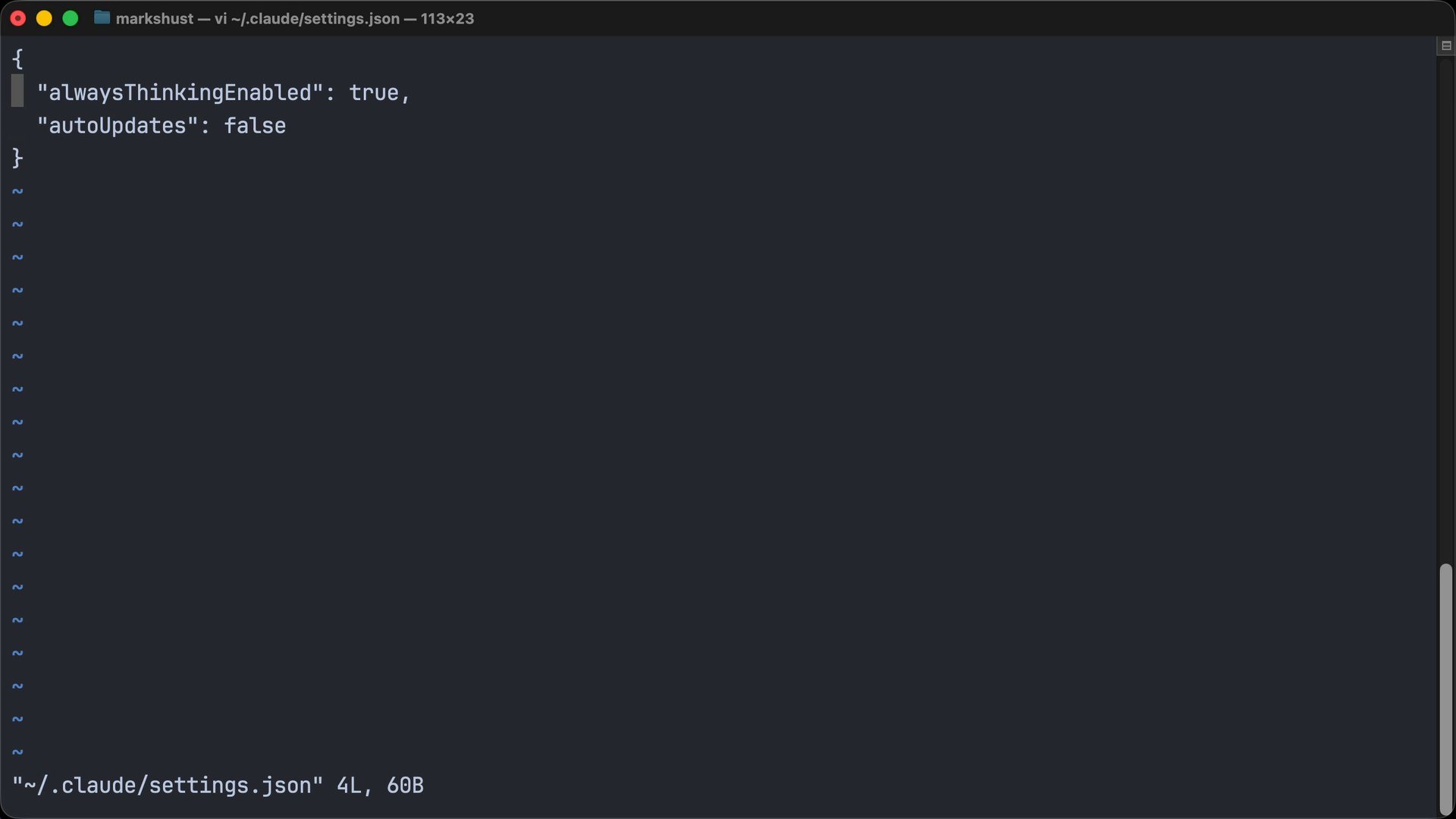 Settings configuration fallback hierarchy in Claude Code