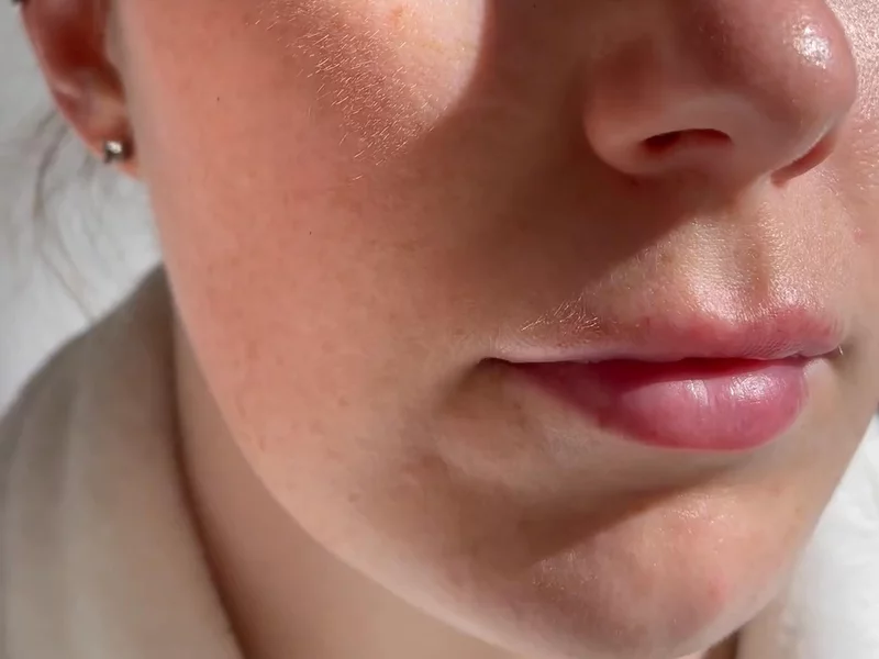 Lash Serum Paid Ad