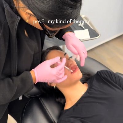 22 Plastic Surgery & Spa MD lip filler result — Cottonwood Heights, UT