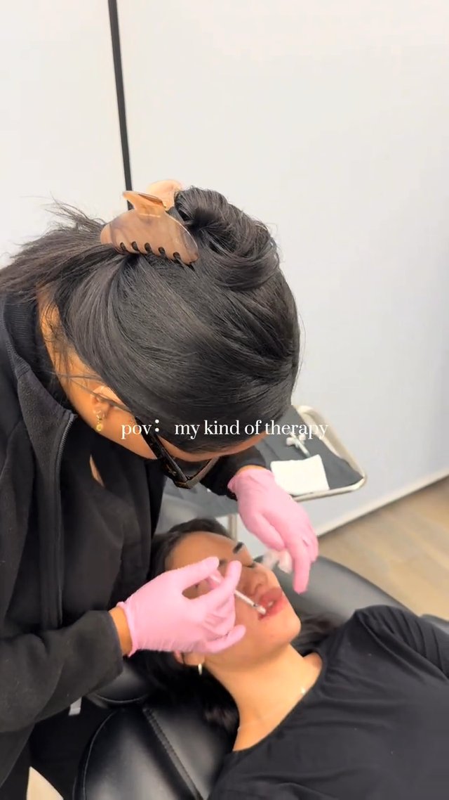 Lip Filler result at 22 Plastic Surgery & Spa MD