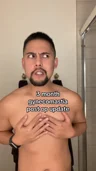 @thejonmichael, about month 3 after gynecomastia surgery