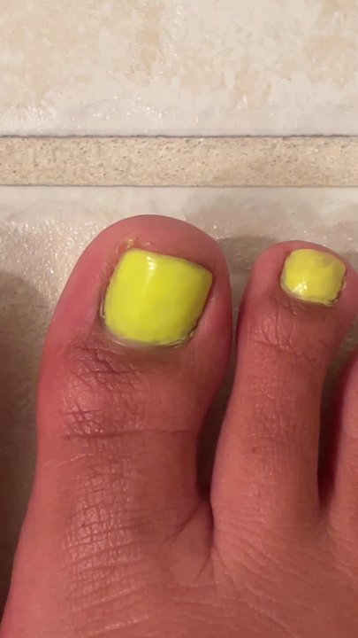 Pinky Nails - Looks absolutely AWFUL !!! not enough toe nail polish !!! Didn't even care to ask me if my pedicure was how I like it !!! - Nail Salons Near Me - San Mateo, California