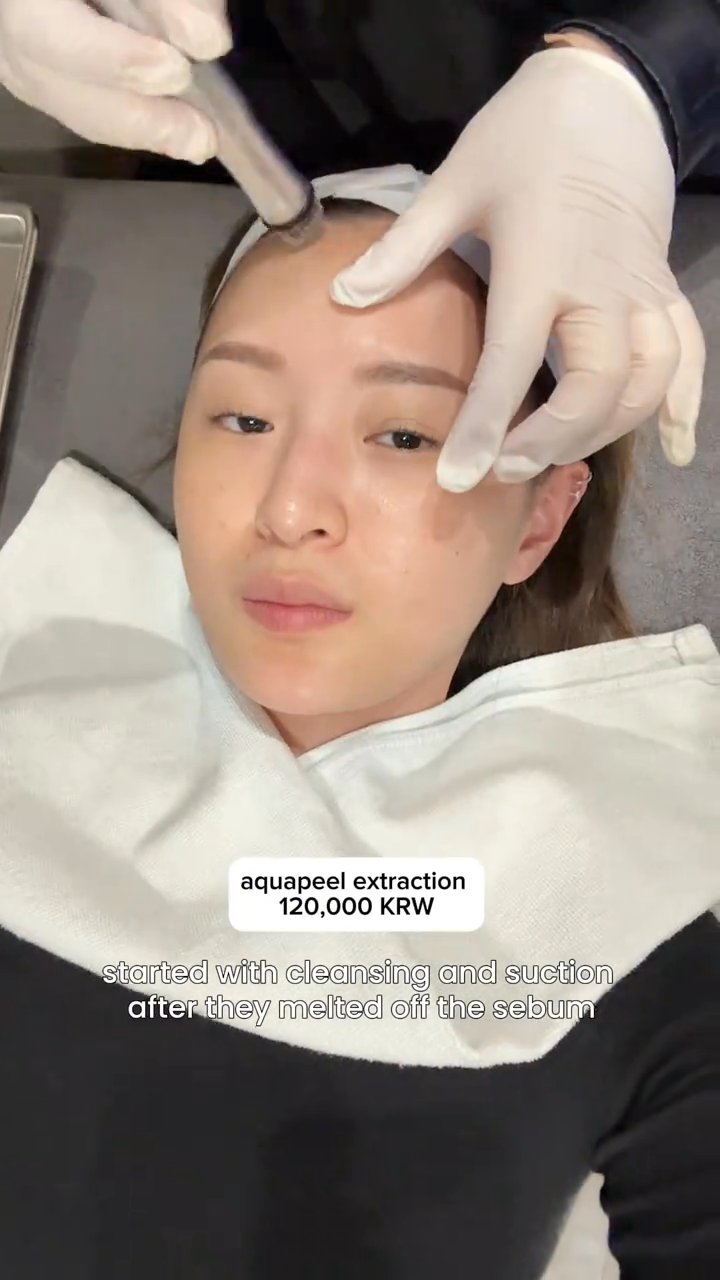 Aquapeel, Acne Extraction, LTM, Double Tight (Benjamin Clinic)