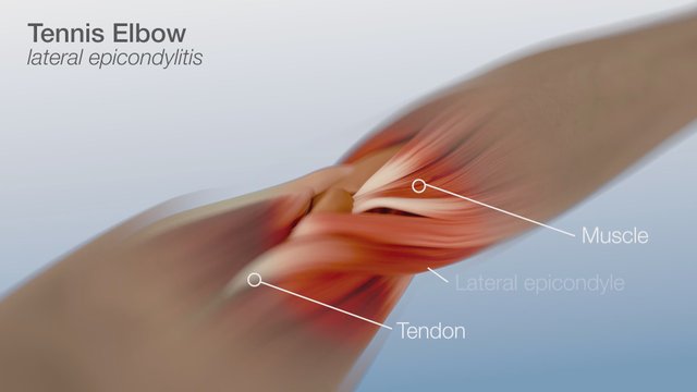Elbow