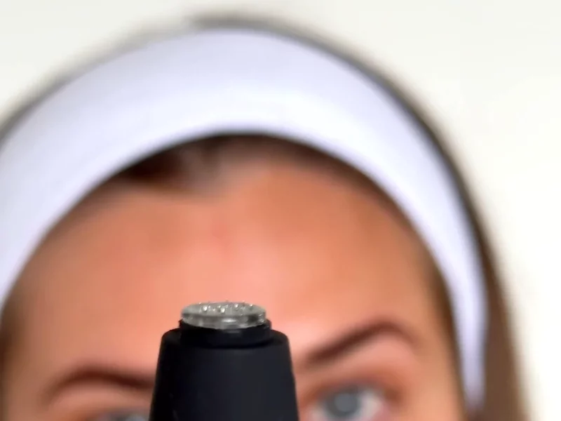 Lonvitalite Microneedle Derma Roller