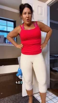 @phatgirlonadiet, day 4 after vertical medial thigh lift with liposuction