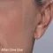 Before & After2