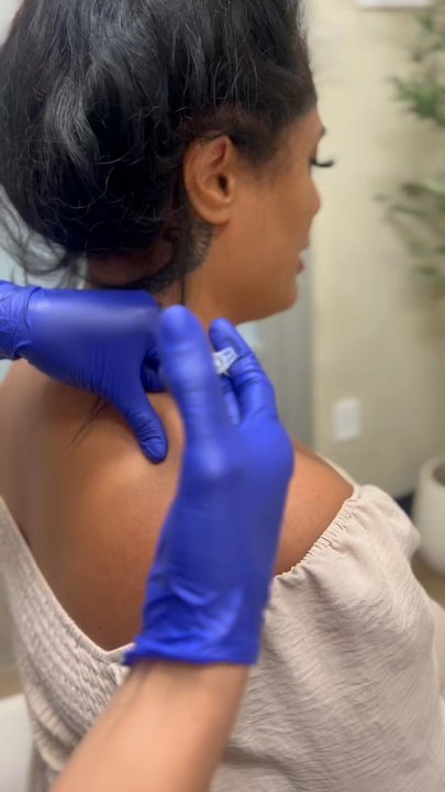 NaturalGlo Aesthetics - Trap Botox. I have shoulder discomfort & tension headaches at the back of my neck. It also has an aesthetic benefit called Swan neck. - Medical Spas Near Me - Temecula, California
