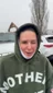 @kimberlyoconnell at her one-week visit after a neck lift