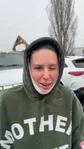 @kimberlyoconnell at her one-week visit after a neck lift
