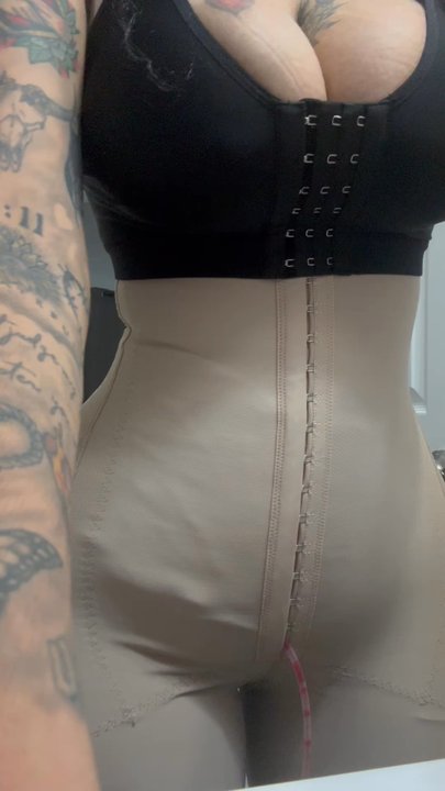 New Life Plastic Surgery - Today after shower - Cosmetic Surgeons Near Me - Miami, Florida