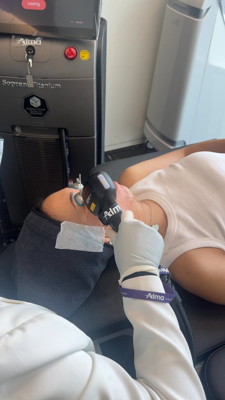 Alma Soprano Titanium HIFU (Benjamin Clinic)