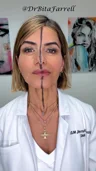 drbitafarrell · Jawline movement