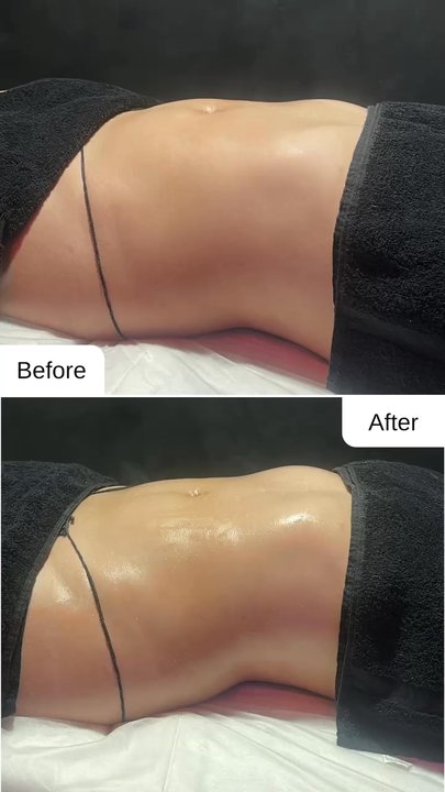 Love Curves - Sandy was amazing, she explained the whole process to me as I was receiving the massage and I already see the difference. - Body Contouring Near Me - Whittier, California