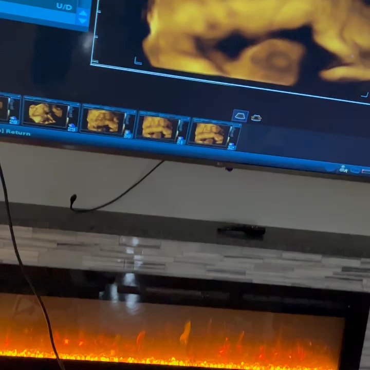 Wonderful reveals - Ultrasound Imaging Centers Near Me