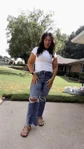@phatgirlonadiet, almost six weeks after vertical medial thigh lift with liposuction