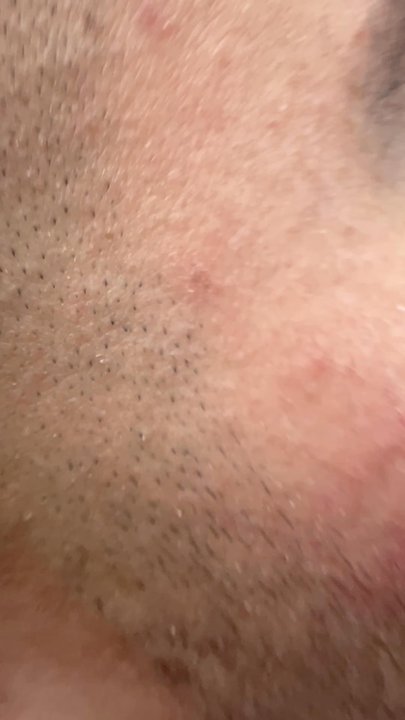 Video thumbnail 2 more videos
