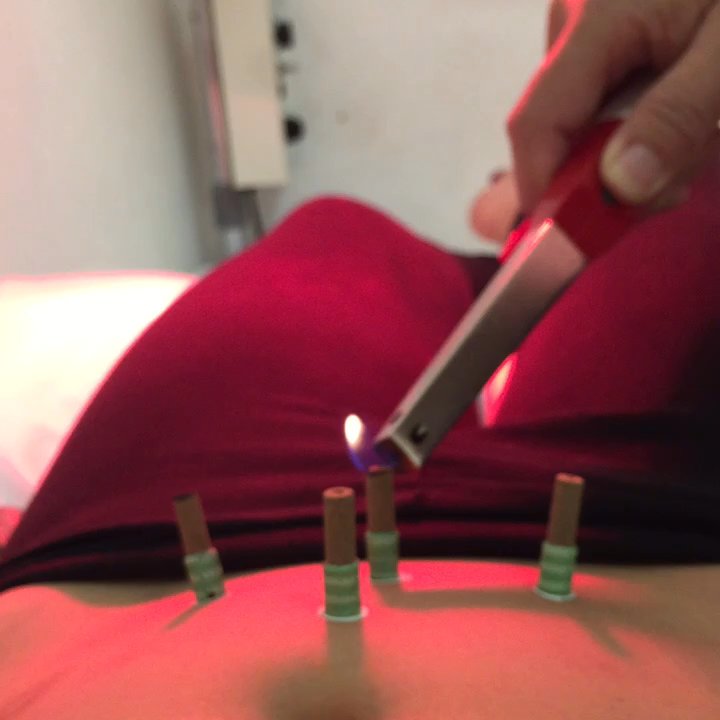 Central Clinic - Acupuncture Near Me - Cerritos, California