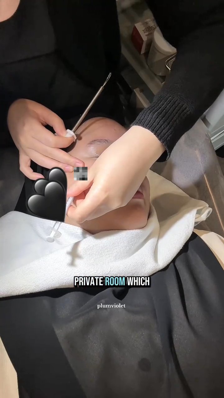 Eye Rejuran, Double Tite, Extraction, Peeling, Blue Light (Benjamin Clinic)